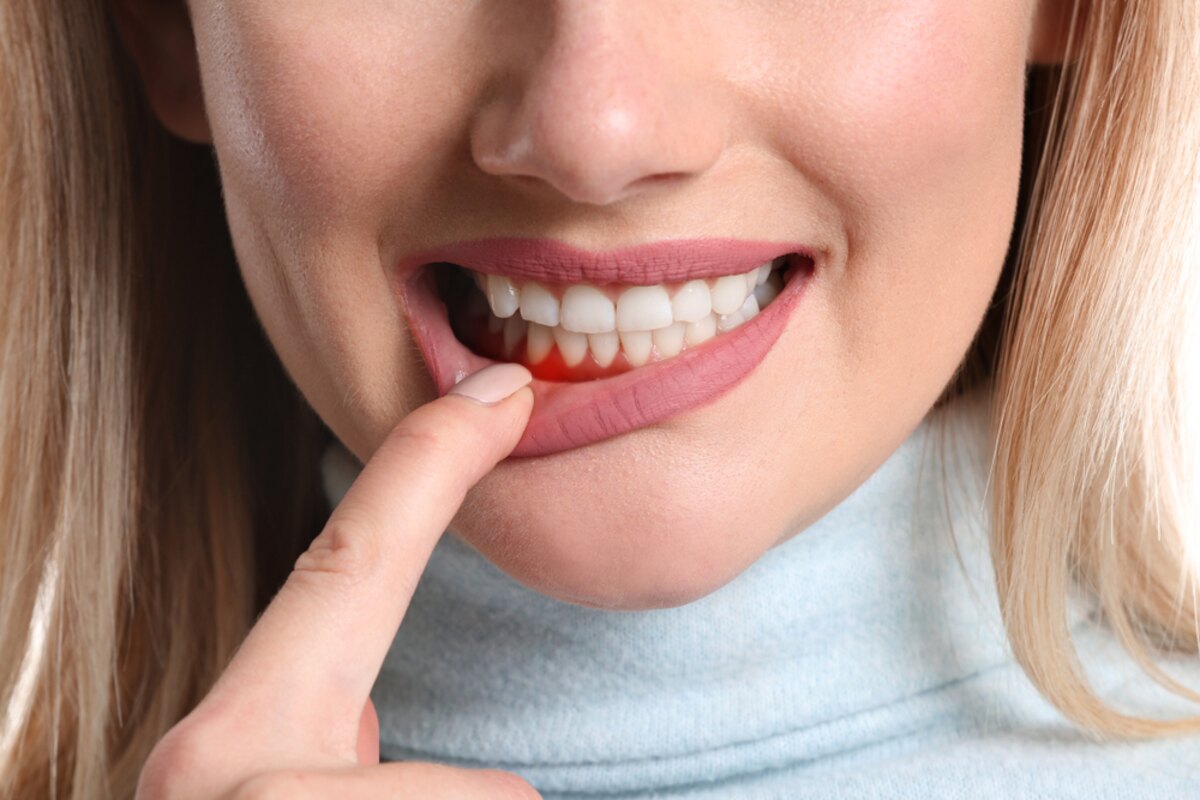 can gum disease affect your heart the oral-systemic connection explained